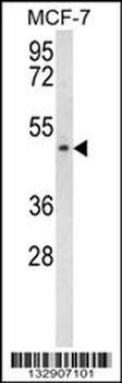 SCD5 Antibody (Center)