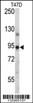 PGR/PR Antibody (Center)
