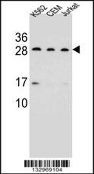 CD79A Antibody (C-term)