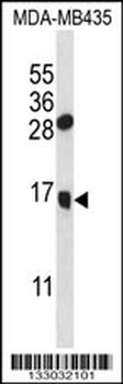 GNLY Antibody (N-term)