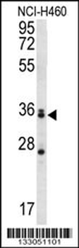 MBNL3 Antibody (Center)