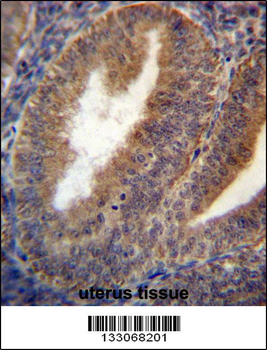 RRAGC Antibody (Center)