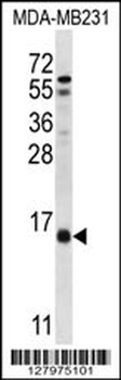 HINT3 Antibody (N-term)