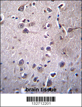 ITM2B Antibody (C-term)