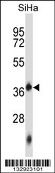 DNTTIP1 Antibody (Center)
