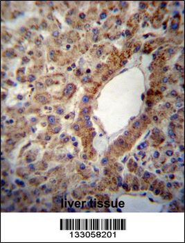 ACSS2 Antibody (Center)
