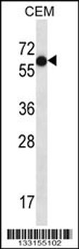 TFAP2B Antibody (C-term)