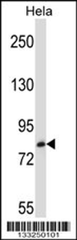 TRIM37 Antibody (C-term)