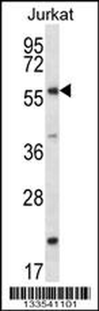 FOXJ3 Antibody (N-term)