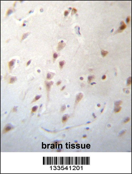 FOXJ3 Antibody (N-term)