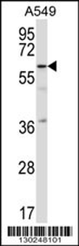 TFCP2L1 Antibody (C-term)