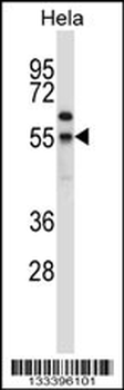 FOXN4 Antibody (N-term)