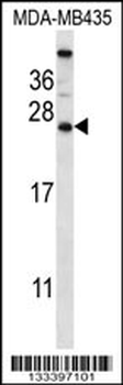 CABP5 Antibody (N-term)
