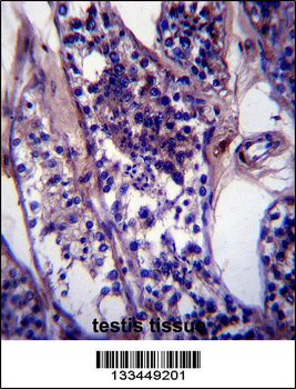 CCDC99 Antibody (C-term)