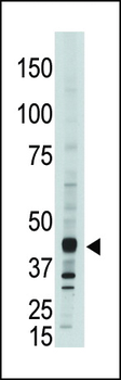 APOBEC3G (CEM15) Antibody (C-term)
