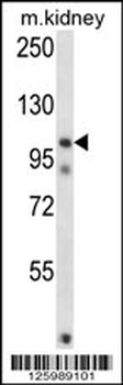FSTL5 Antibody (N-term)