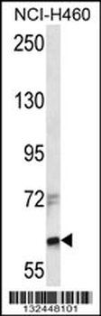 ZFX Antibody (Center)