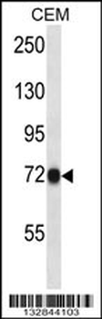 CNNM4 Antibody (C-term)