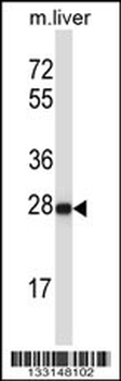 HELT Antibody (Center)