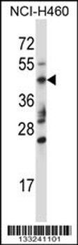 TRIM15 Antibody (Center)