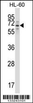 TRIM23 Antibody (N-term)