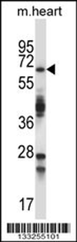 TRIM45 Antibody (C-term)
