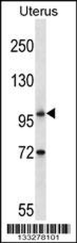 ATG9B Antibody (C-term)