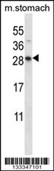 DOLPP1 Antibody (C-term)