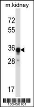 ABHD4 Antibody (Center)