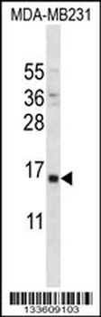 PTH Antibody (Center)