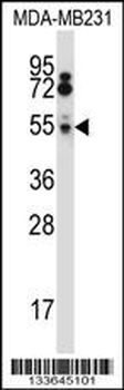 HTRA2 Antibody (N-term)