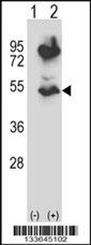HTRA2 Antibody (N-term)