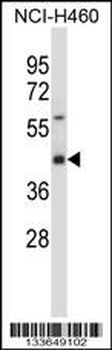 SYT1 Antibody (C-term)