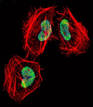 HDAC4 Antibody (C-term)