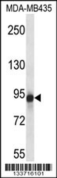 GRM6 Antibody (Center)