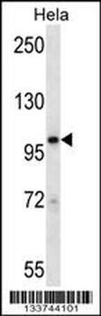STAT2 Antibody (N-term)