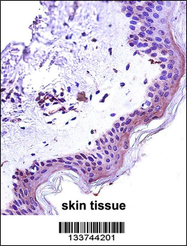 STAT2 Antibody (N-term)