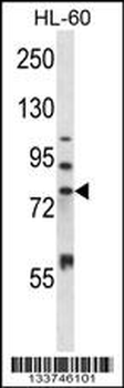 MMP15 Antibody (N-term)