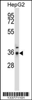 PPP4C Antibody (Center)