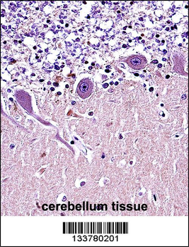 CRMP1 Antibody (N-term)