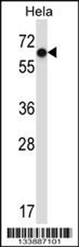 NR0B1 Antibody (Center)