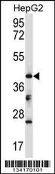 Mouse Bckdk Antibody (Center)