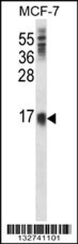 LY6E Antibody (Center)