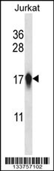 CENPA Antibody (Center)