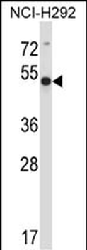 ACTR6 Antibody (C-term)