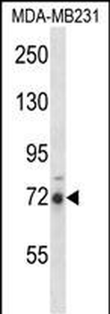 RIPK1 Antibody (N-term)