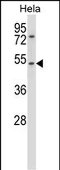 CHRNA7 Antibody (N-term)