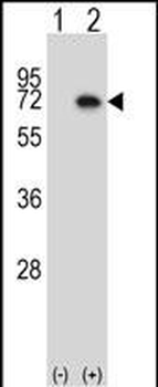 Mouse Map3k7 Antibody (N-term)