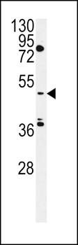 MIST Antibody (Center)