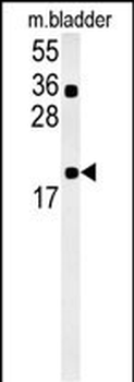 CCDC12 Antibody (N-term)